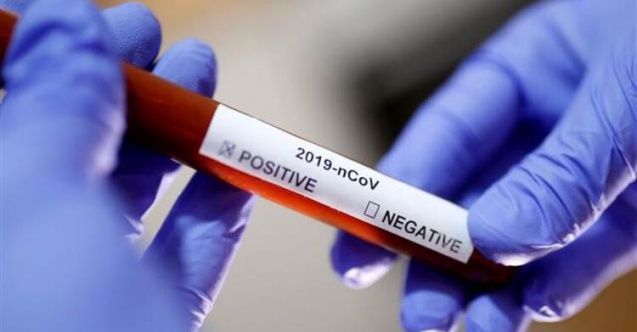 Türkiye'de Mutasyonlu Virüsün Bulunduğu İller